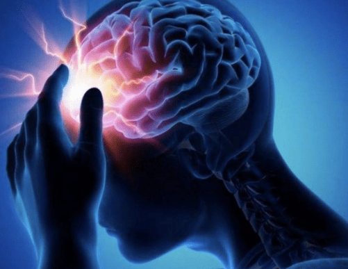 Hasta seis de cada diez pacientes con ACV desarrollan espasticidad en los primeros seis&nbsp;meses